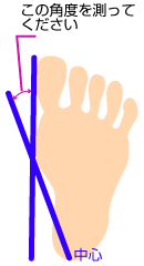 外反母趾施術　伊東市健康スポーツ整体院