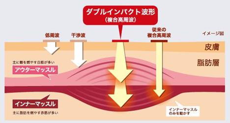 コアレイメージ200